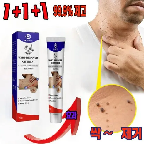가성비 최고 사마귀연고 Top5