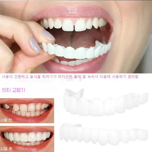 가성비 최고 임시틀니 Top5